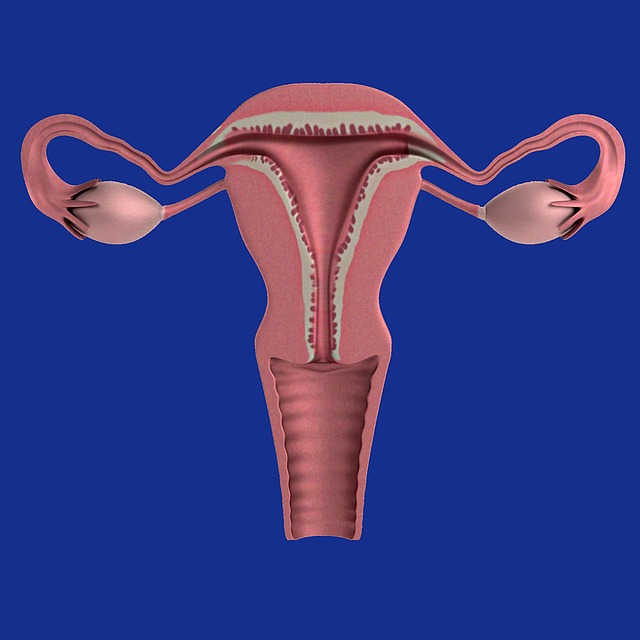 Uterus- Endometriosis